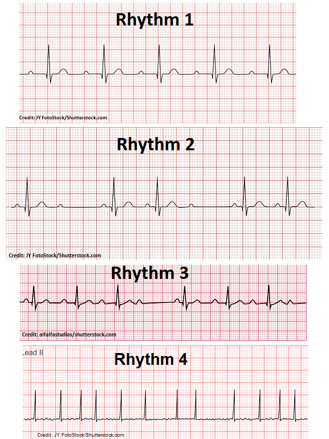 free ekg practice