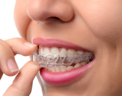 dental braces services for kids maple ridge