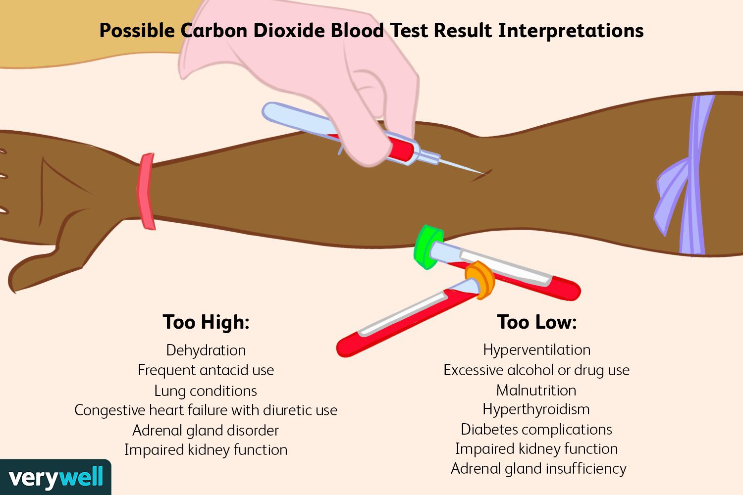 co2 levels low in blood