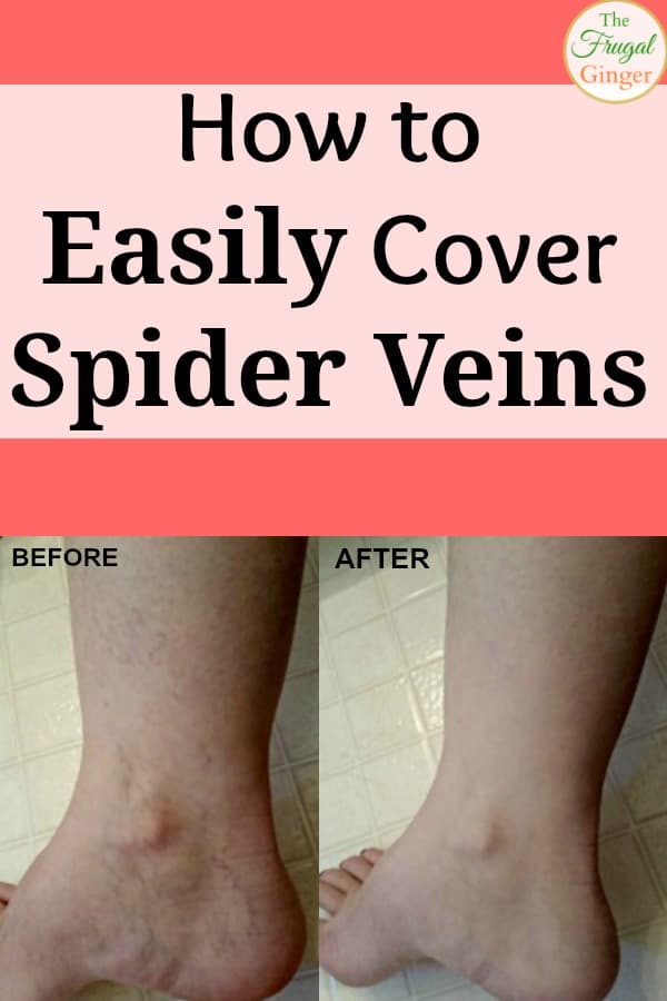 waterproof leg makeup to cover veins