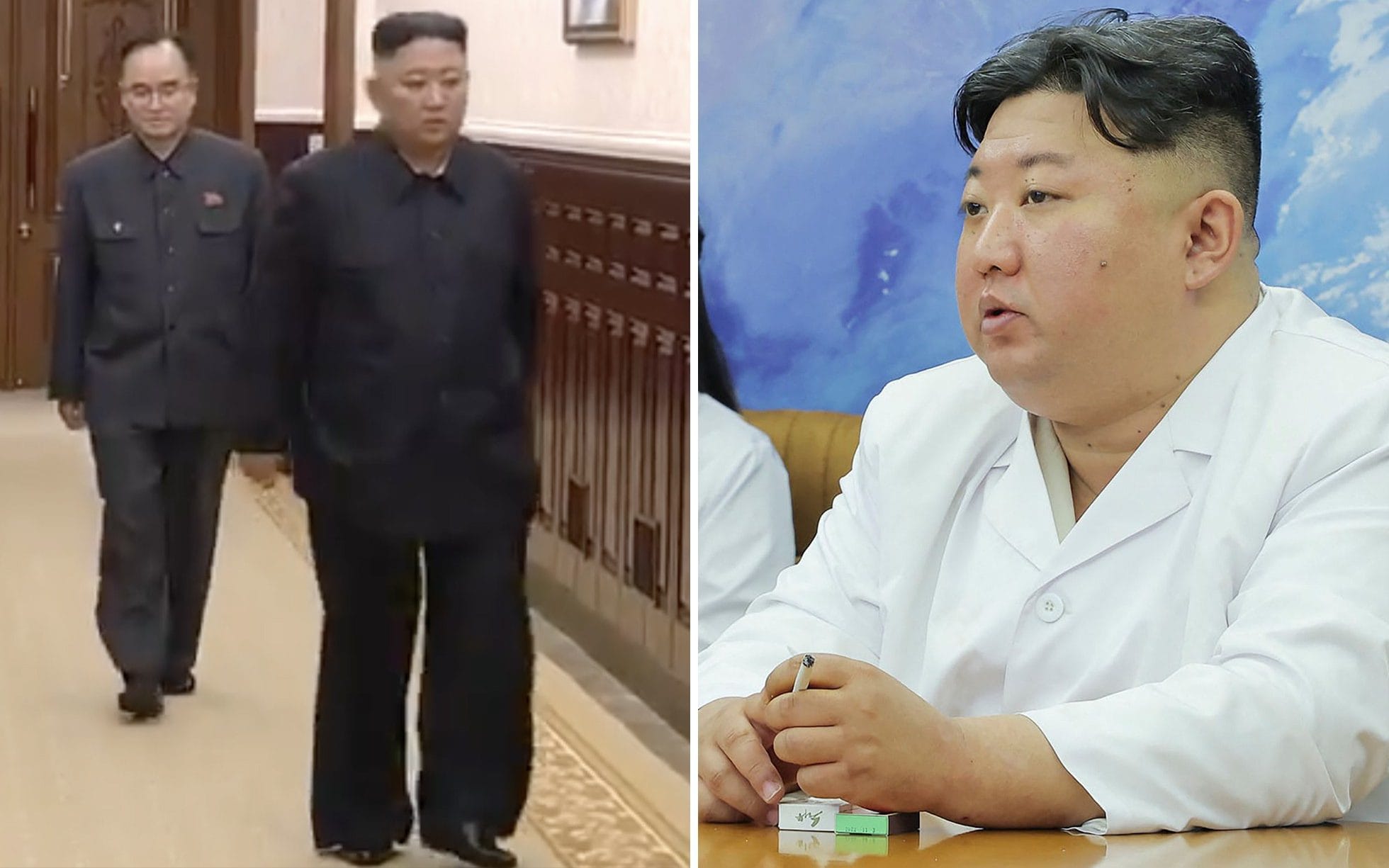 kim jong un weight loss