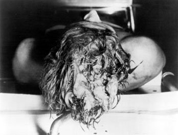 kennedys autopsy