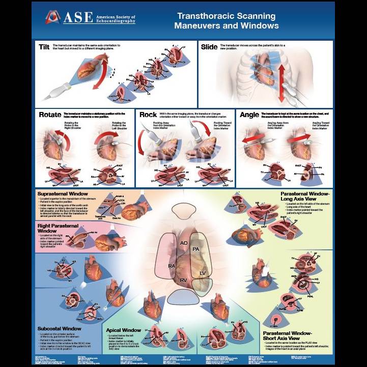 echocardiography poster