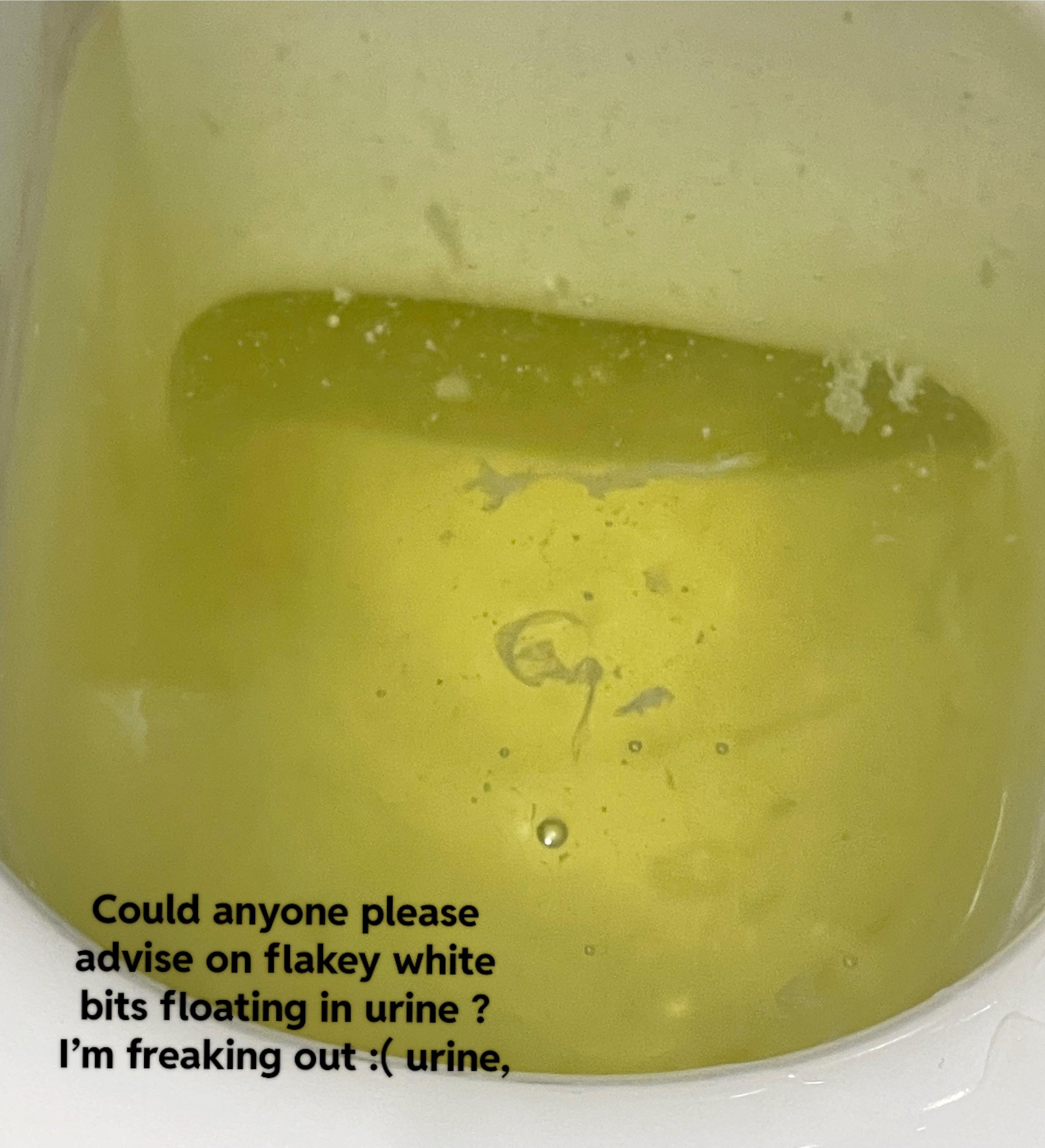 floaters in pee