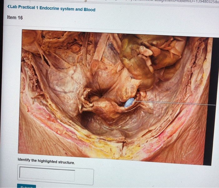 identify the highlighted structure endocrine system