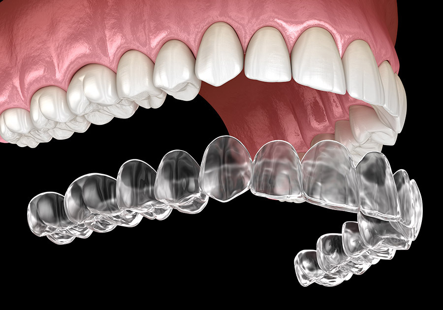 invisalign stamford ct