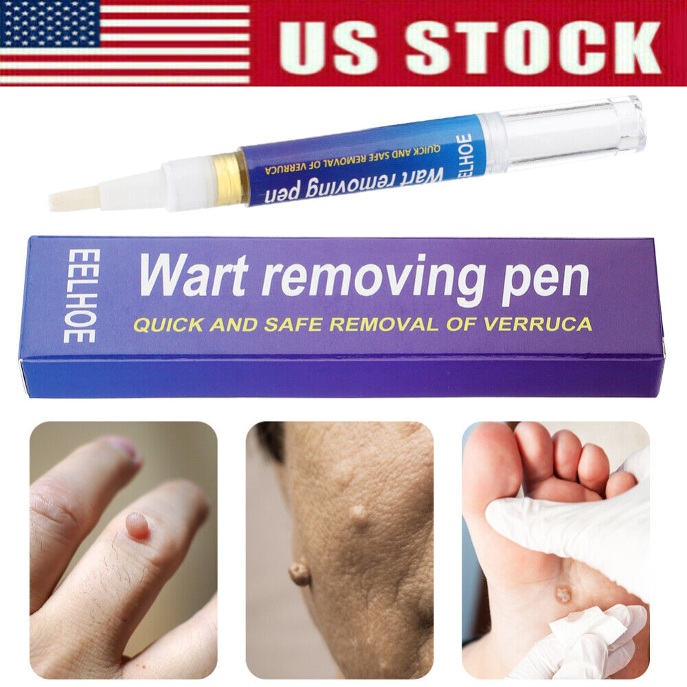 wart removal pen