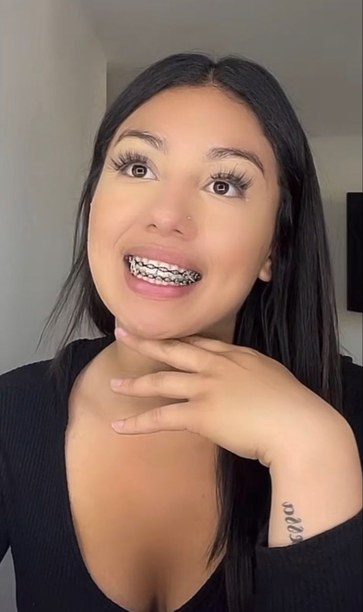 latina braces