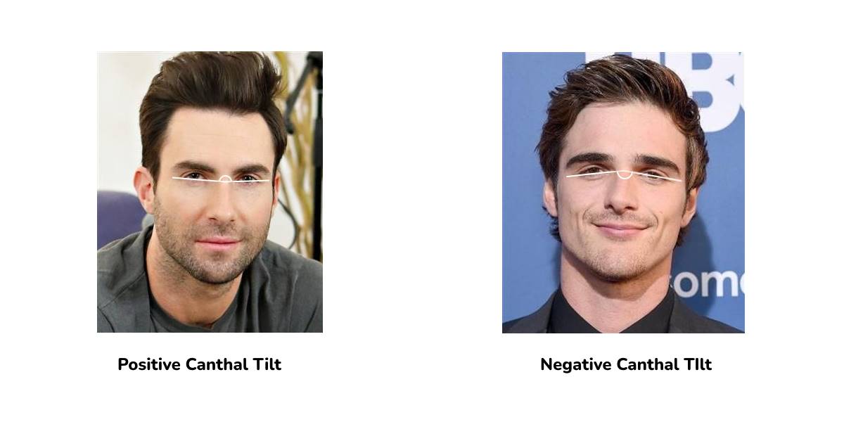 attractive negative canthal tilt