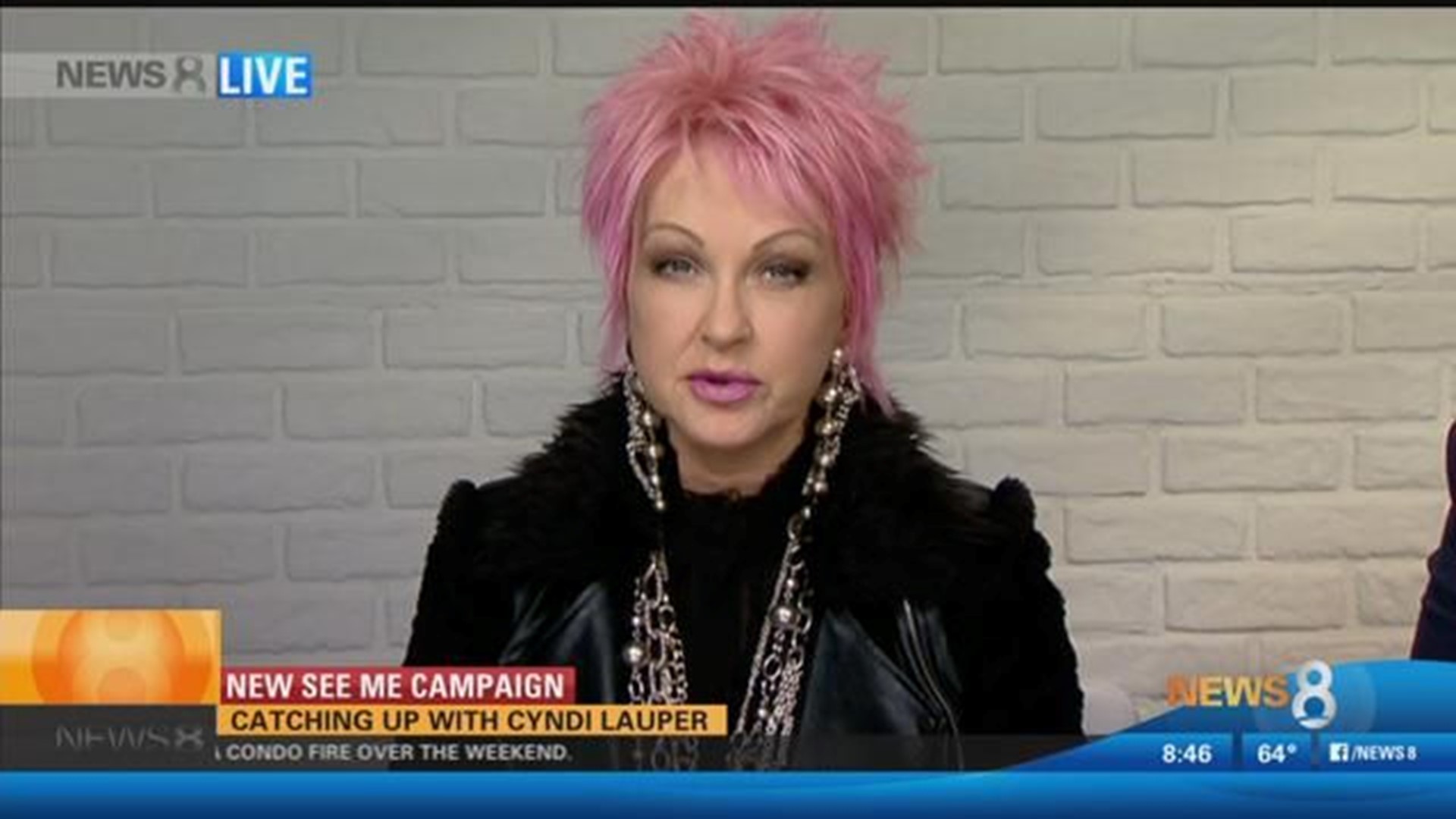 cyndi lauper in psoriasis commercial