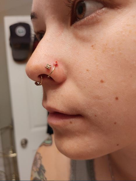 how to get rid of nose ring infection