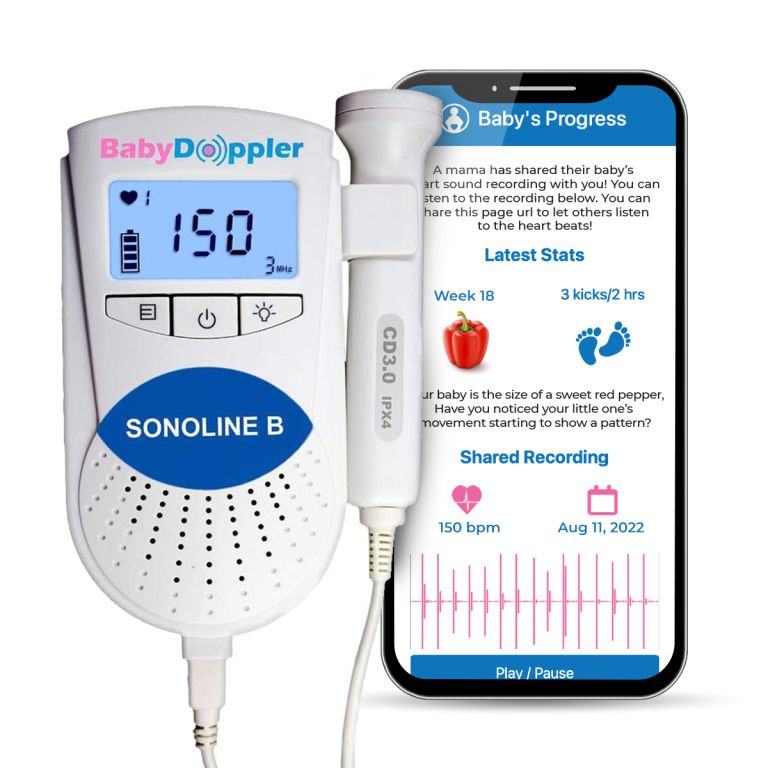 baby doppler sonoline b