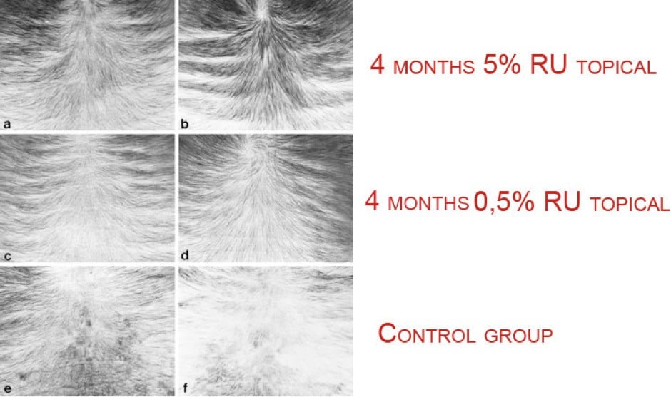 ru58841 side effects