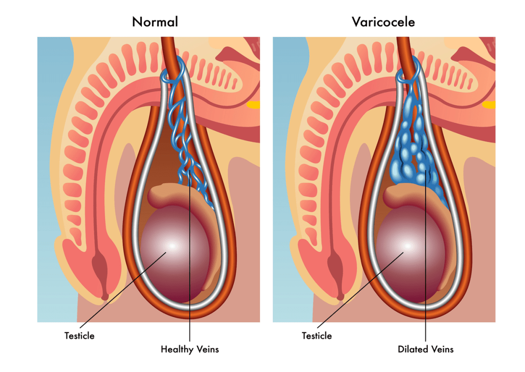 vibration in testicles