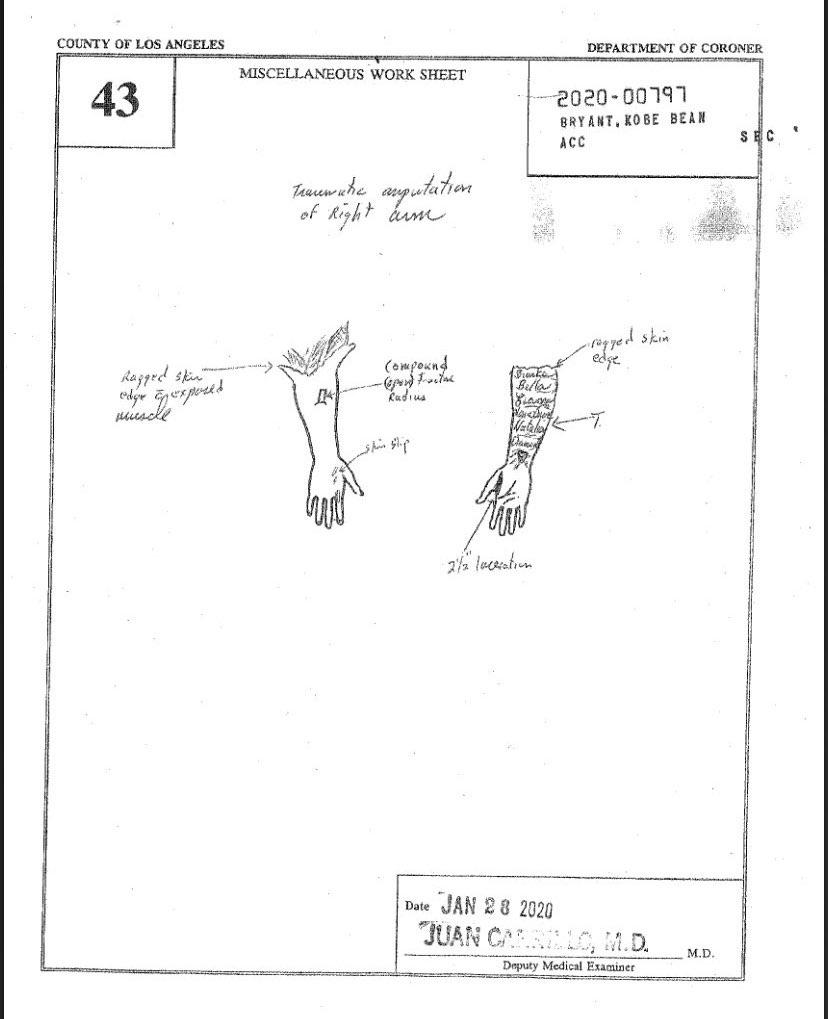 gigi bryant autopsy pictures