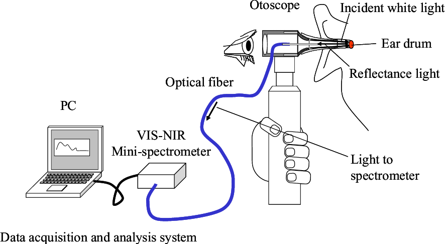 otoscope diagram