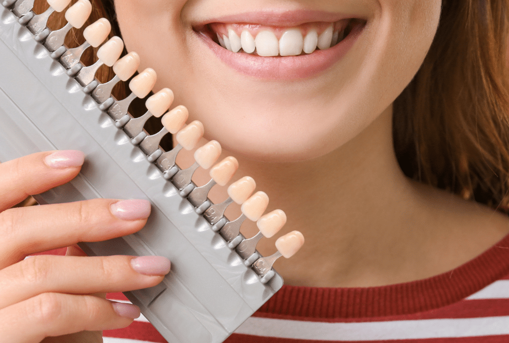 dental veneer consultation maple ridge