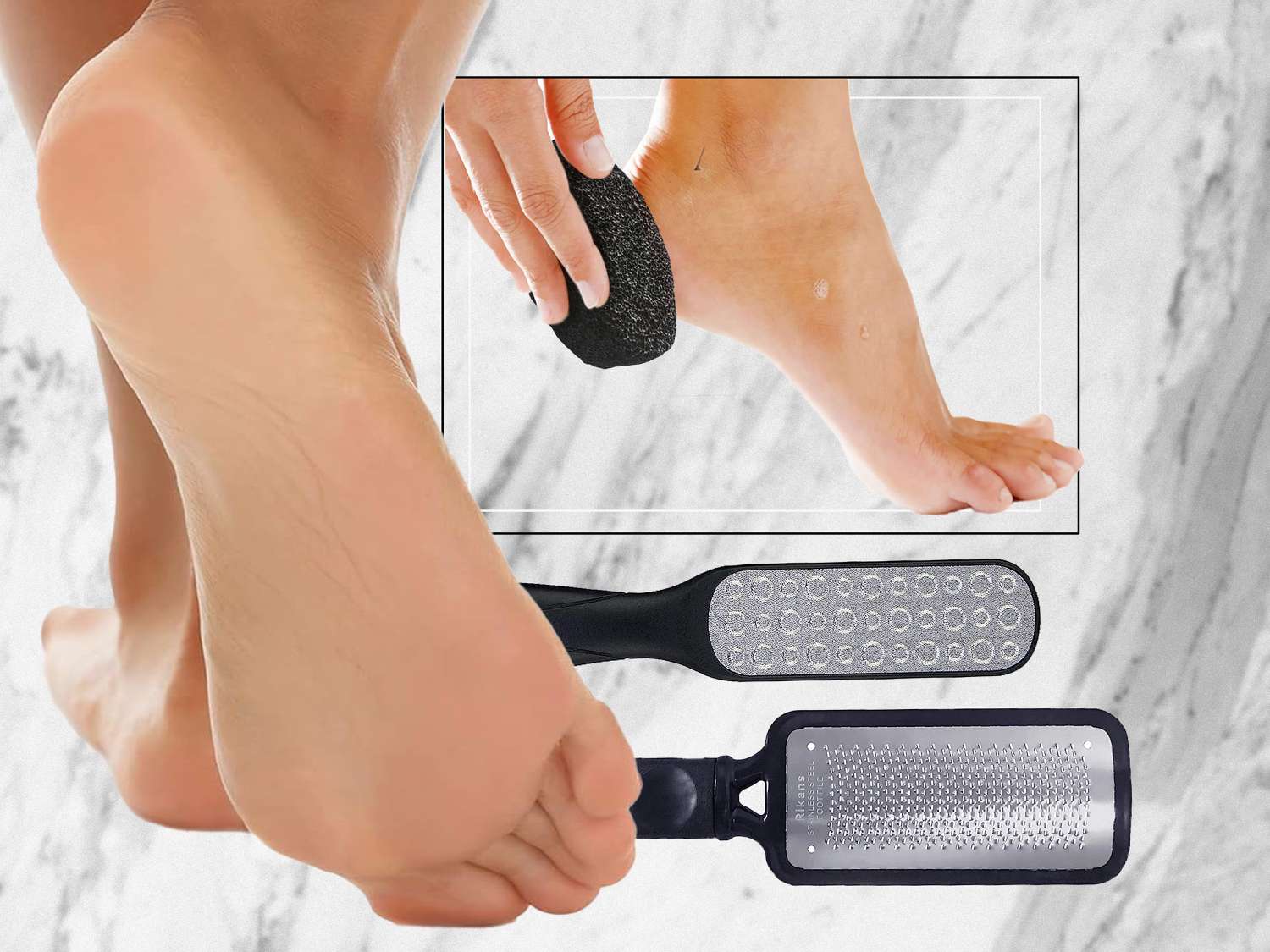 best foot callus remover