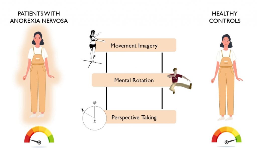 anorexia nervosa