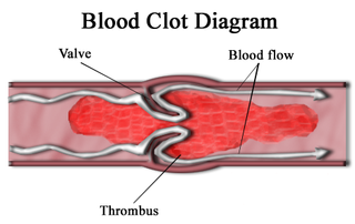 coagulate meaning in hindi