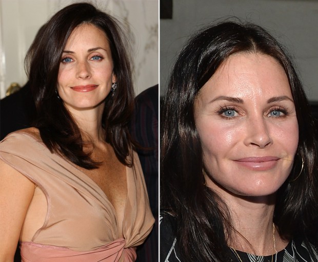 courtney cox boobjob