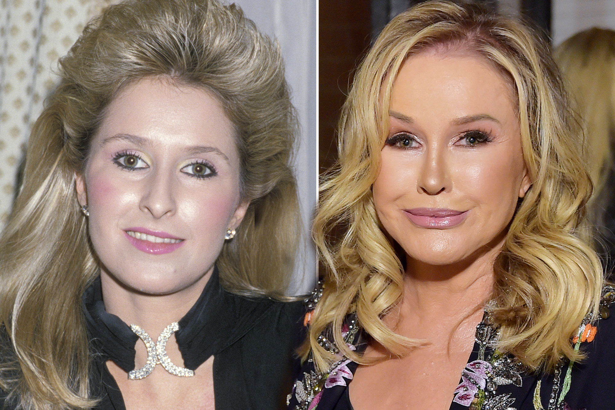 kathy hilton