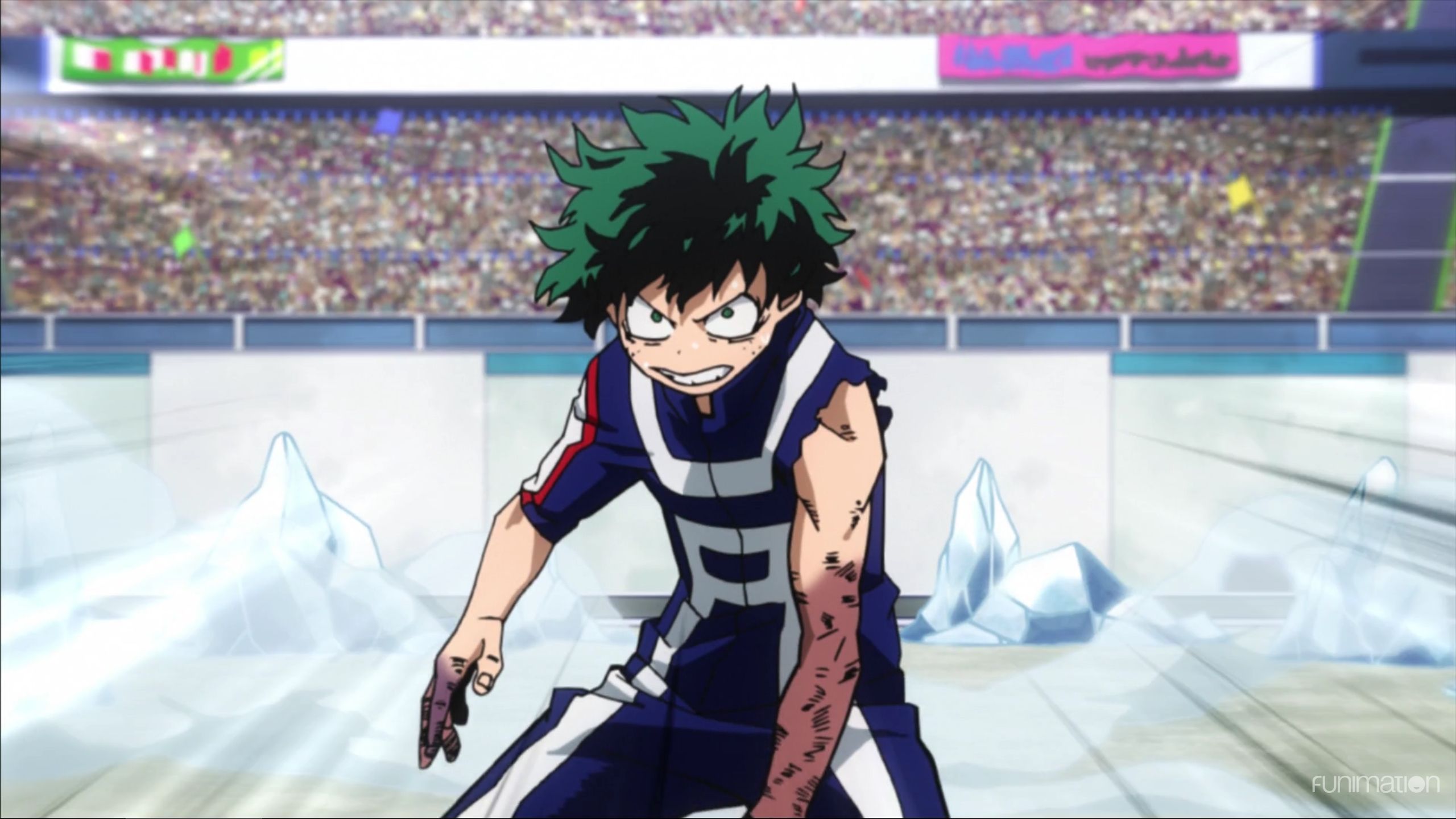 deku broken arms