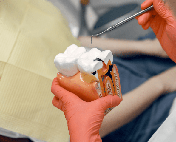 dental root canals treatment maple ridge