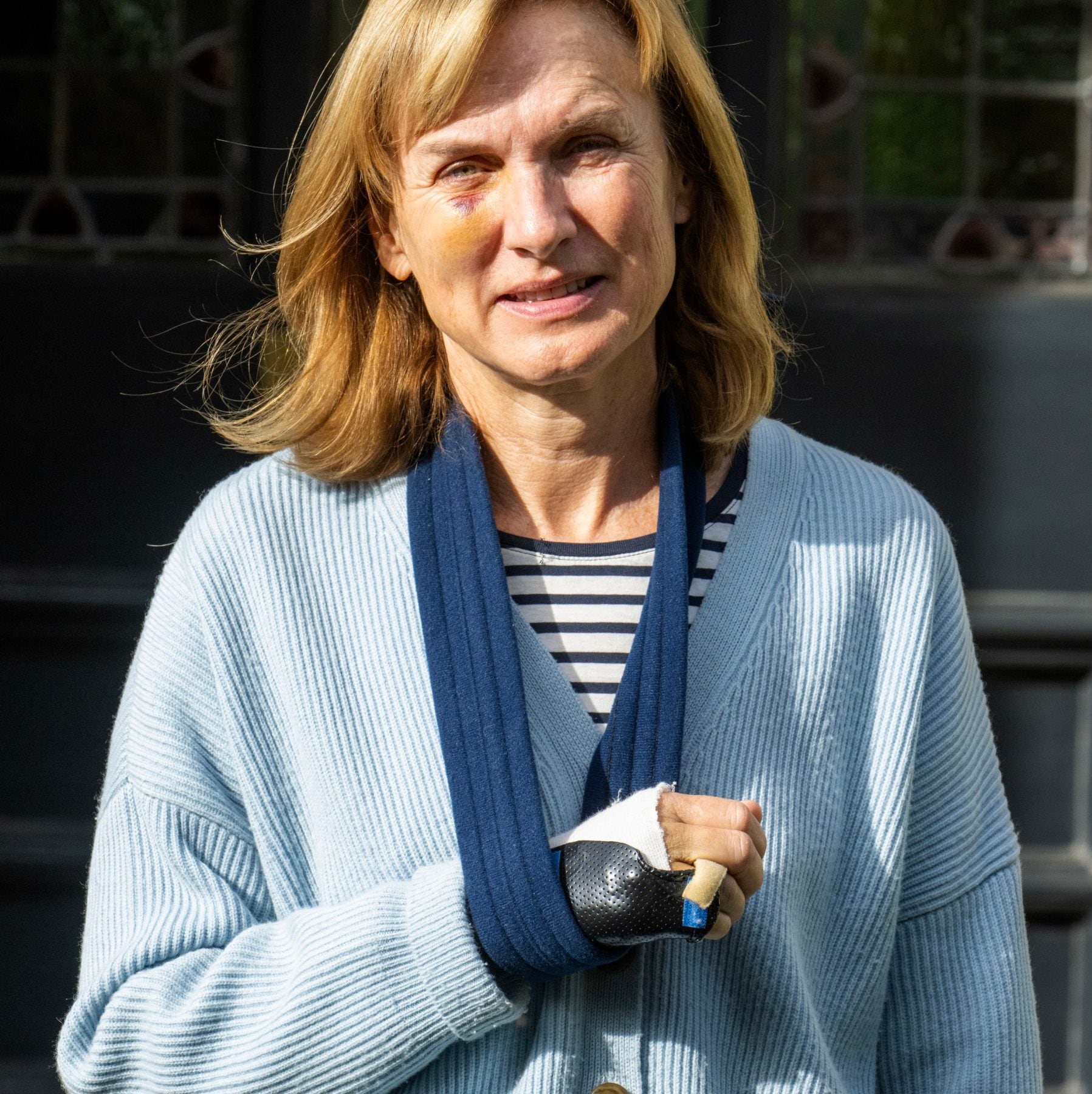 fiona bruce controversy