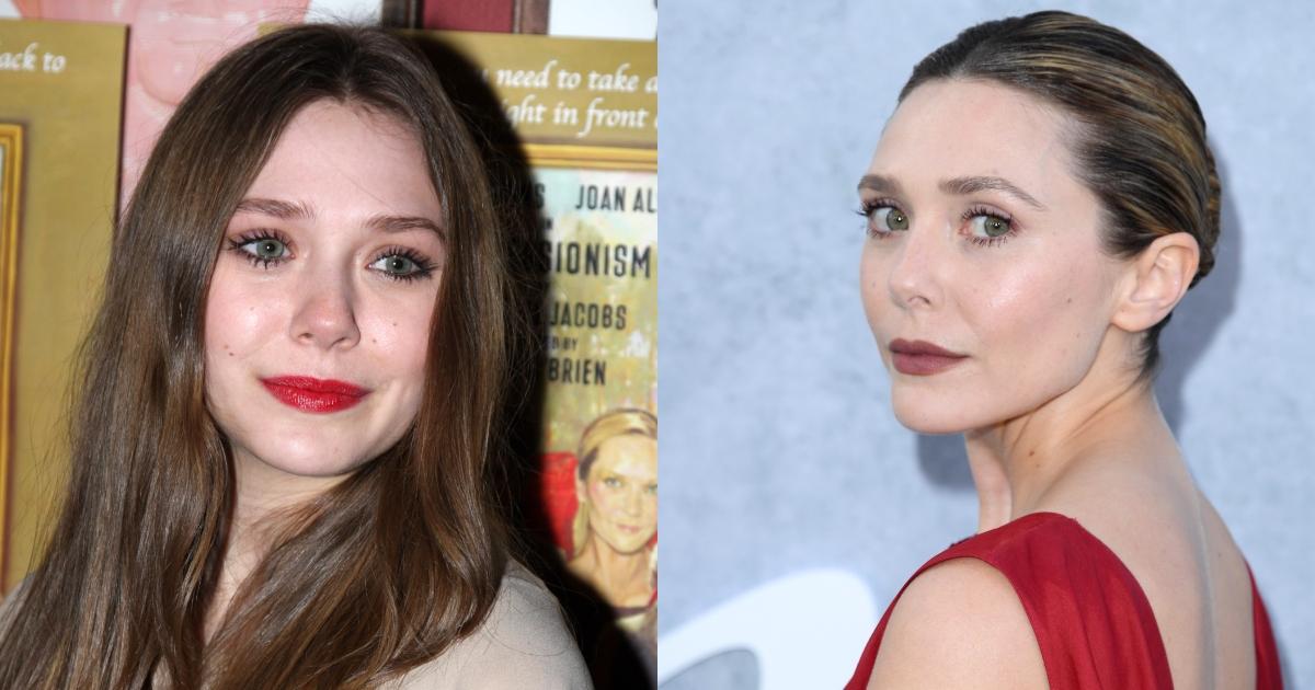 elizabeth olsen plastic surgery