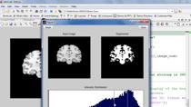 imaging matlab