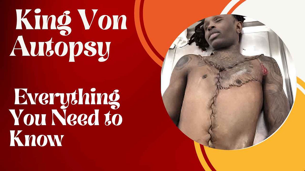 king vons autopsy picture