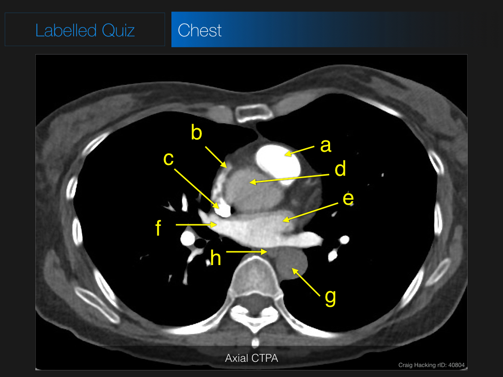 radiopaedia quiz