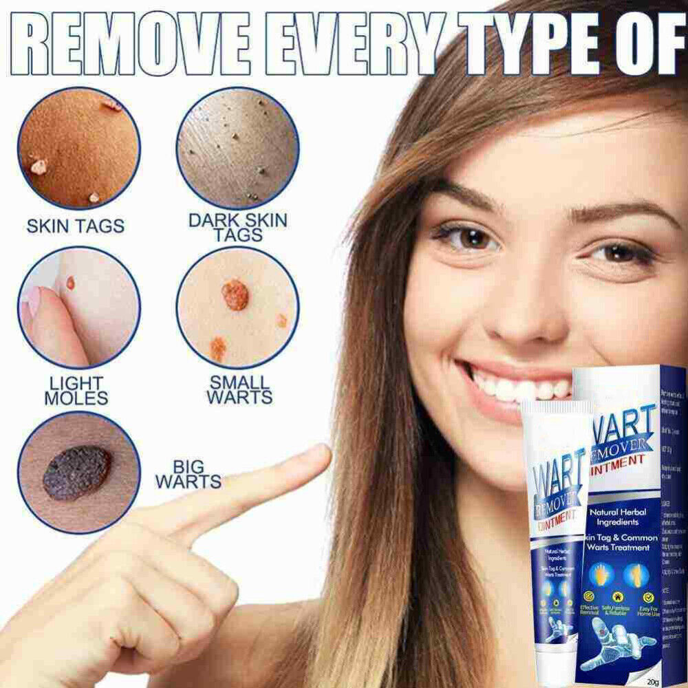 skin tag and wart remover