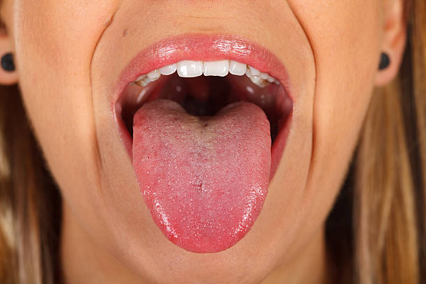 unhealthy tongue pics