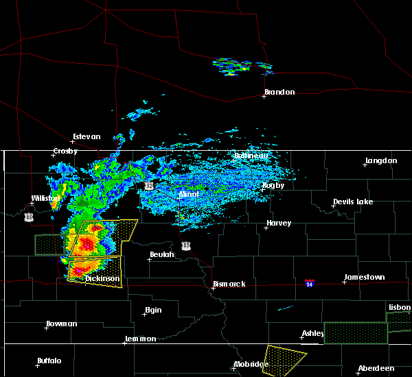 weather radar killdeer nd