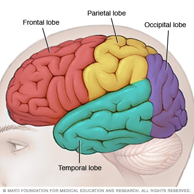 what is temporal lobe epilepsy